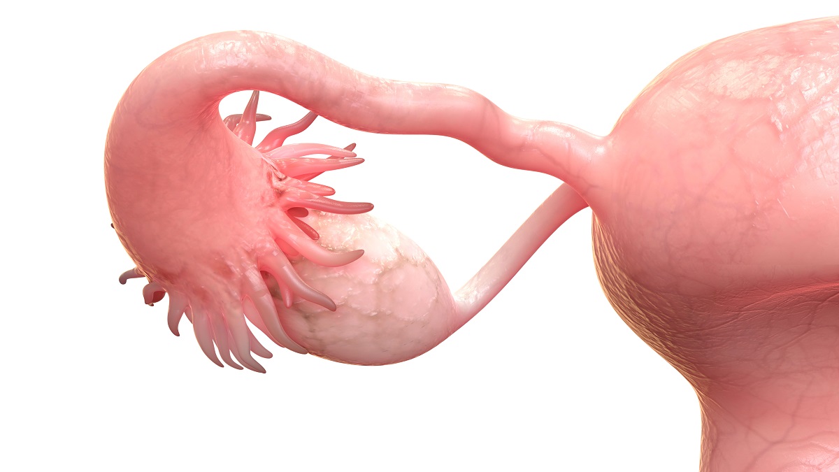 Anatomicky znázornený vaječník a vajcovod. Zdroj: Getty Images