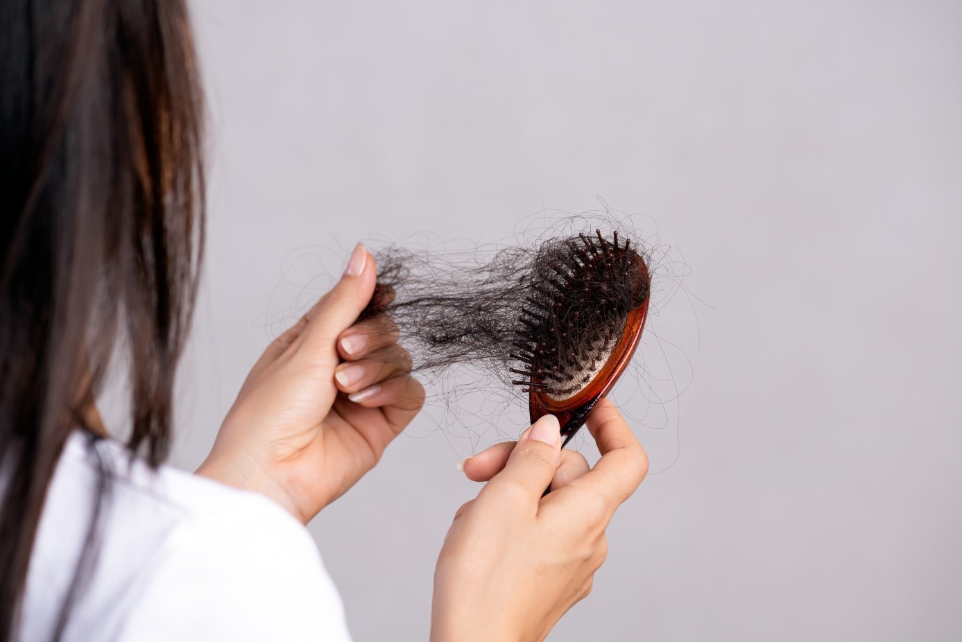 Alopécia (stav zníženého množstva vlasov): Aké má príčiny a príznaky?
