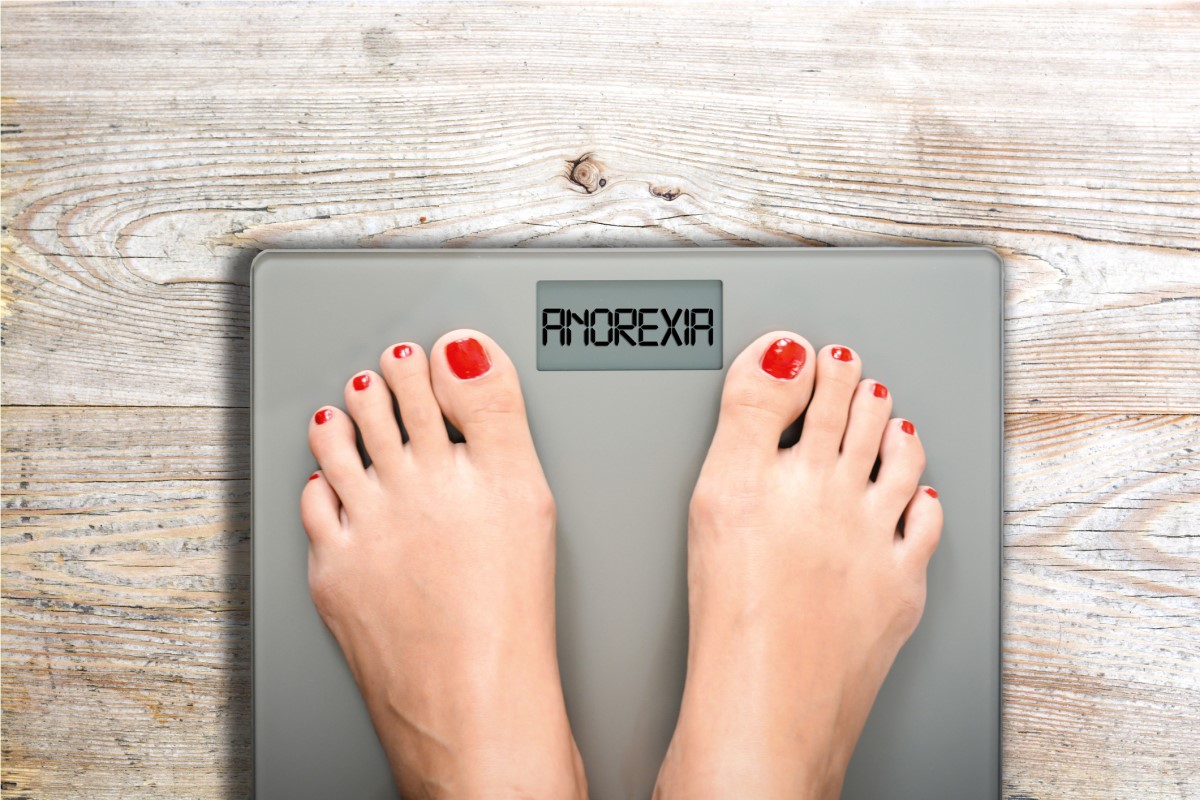 Anorexia ako pohľad na vlastnú príliš vysokú váhu, ktorá však neodráža skutočnosť a dotyčná osoba si neuvedomuje ohrozenie vlastného zdravia a života - nohy na váhe s nápisom anorexia
