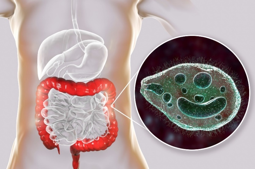 Balantidum coli – parazit napádajúci hrubé črevo tráviaceho traktu človeka