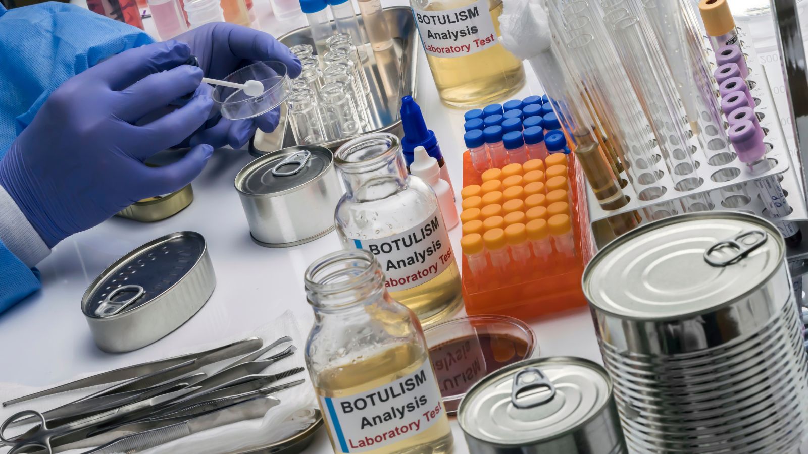 Botulotoxín sa dokazuje laboratórnymi testami. Zdroj foto: Canva Laboratórne testy vzoriek na prítomnosť botulotoxínu