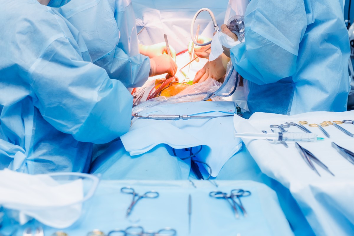 Chirurgická liečba - brušná operácia a lekári a zdravotníci na operačnom sále operujú pacienta