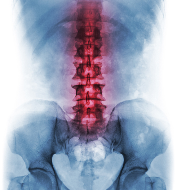 Model chrbtice zvýraznená spodná časť