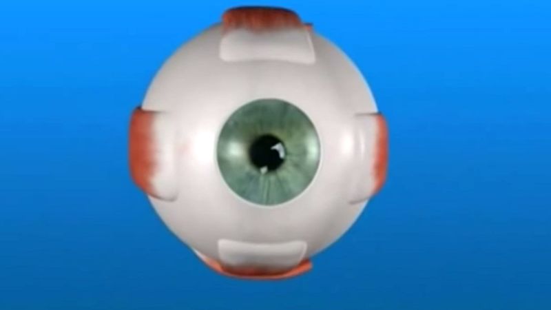 Diabetická retinopatia