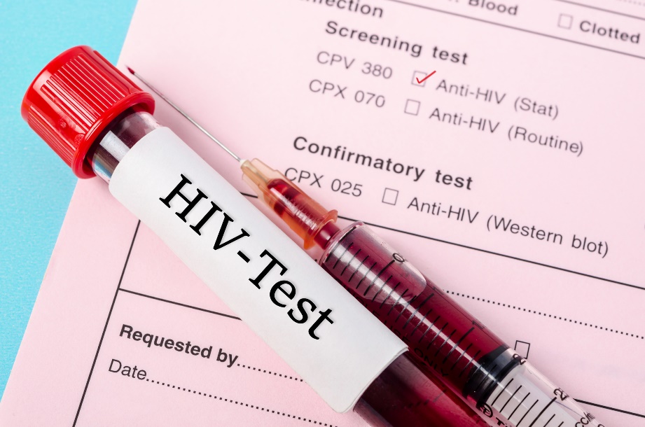 Diagnostický test na prítomnosť Anti-HIV protilátok v krvnej vzorke pacienta