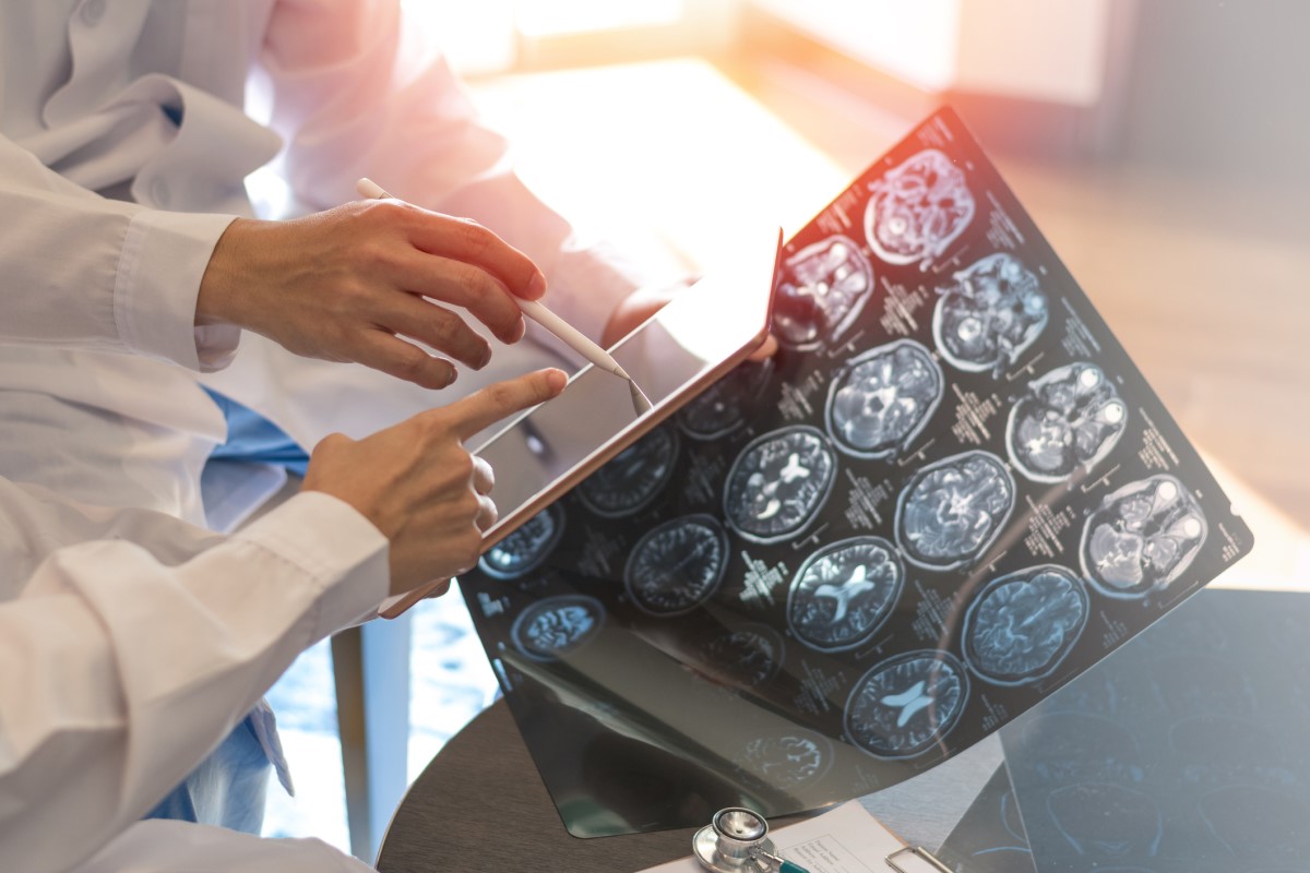 Snímky mozgu, ako základ vyšetrenia, lekár drží snímky v ruke, v druhej má tablet, hodnotí stav