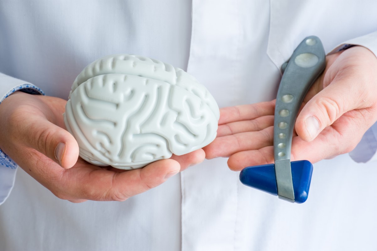 Vyšetrenie u neurológa, lekár drží v ruke model mozgu a neurologické vyšetrovacie kladivko