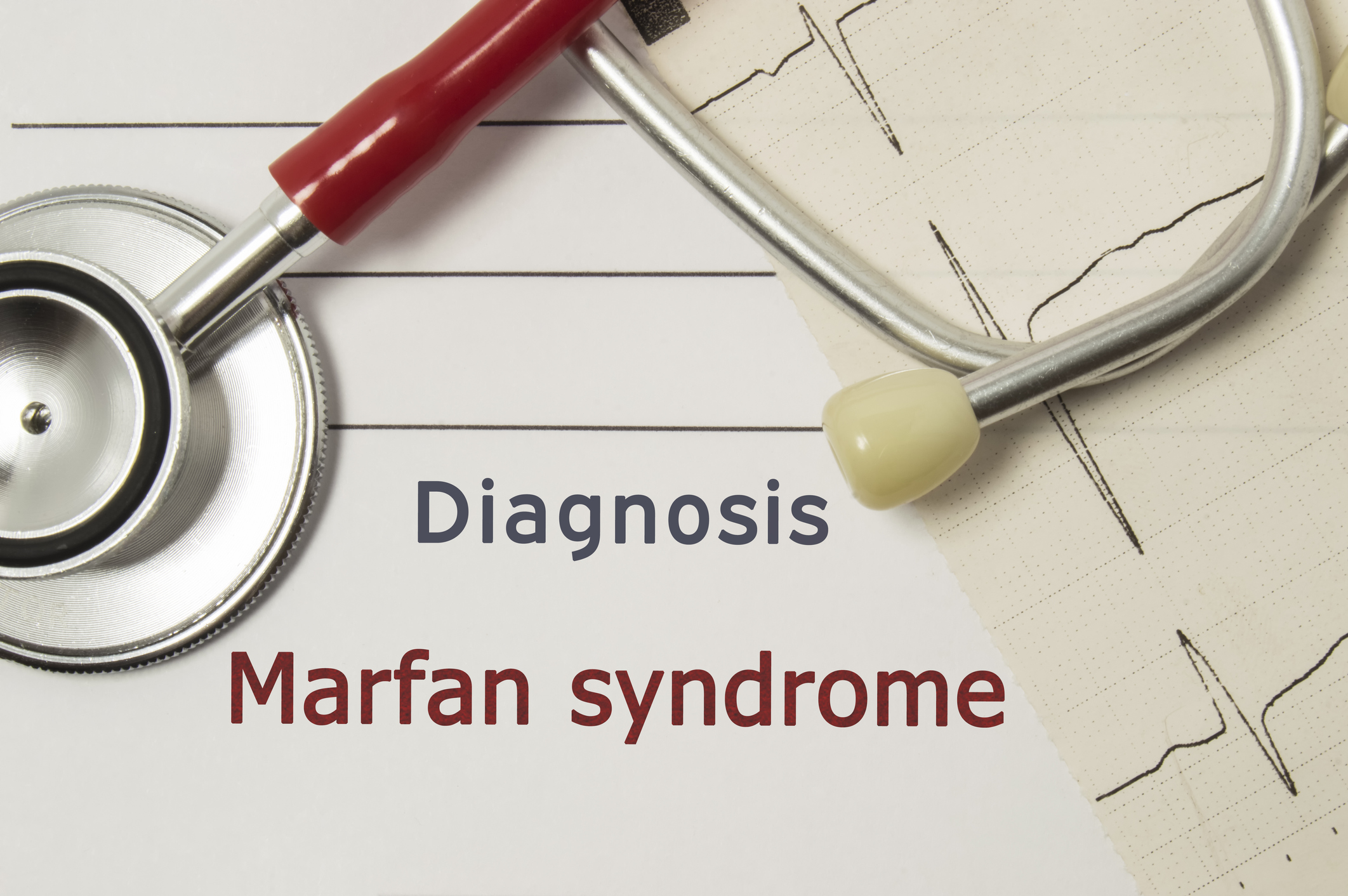 Marfanov syndróm