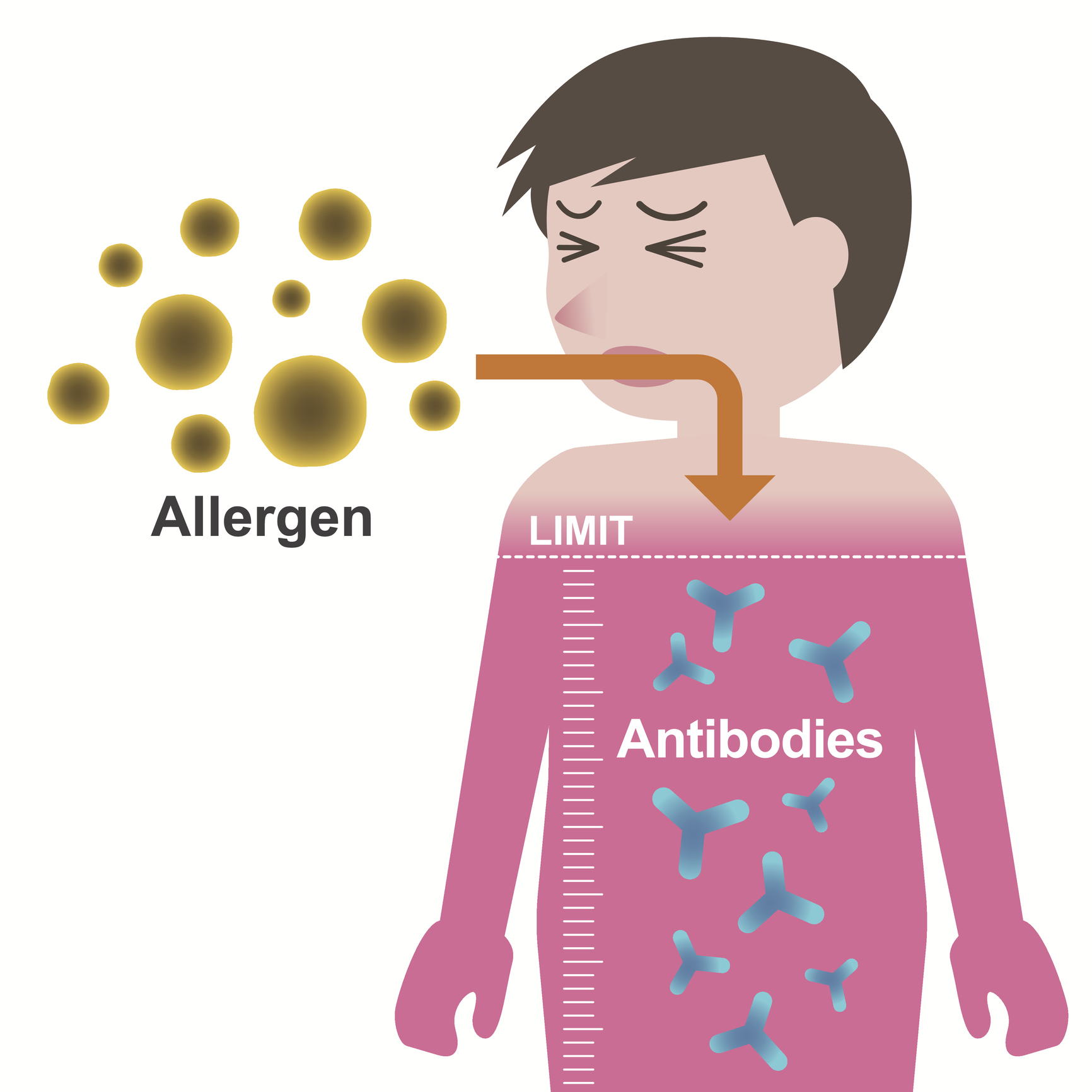 Mechanizmus rozvoja alergie