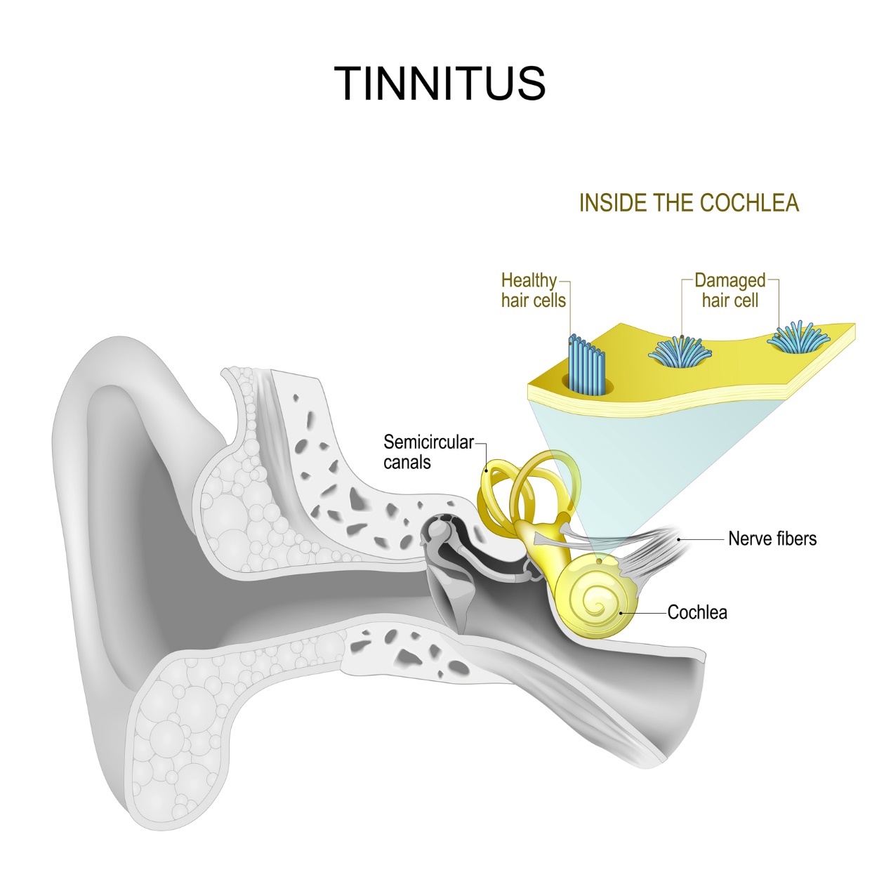 Vnútorné ucho a tinitus - pískanie a hučanie v uchu