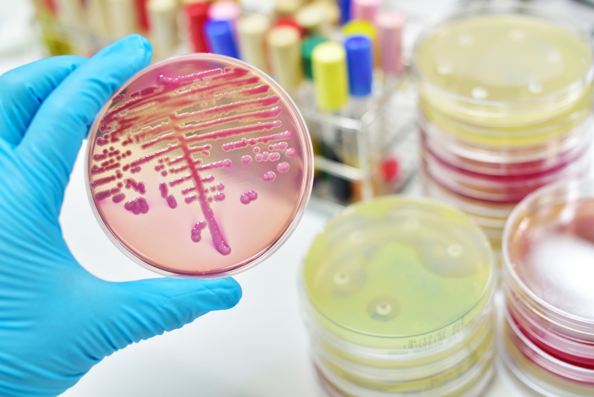 Mikrobiologické vyšetrenie - kultivácia - kolónie baktérií na miske