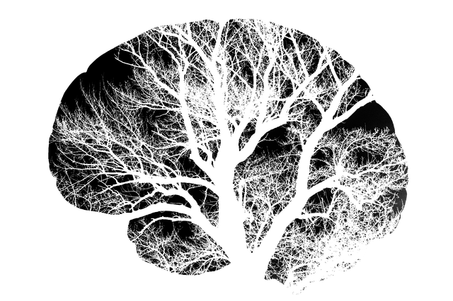 Model mozgu