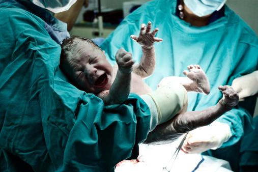 plačúci novorodenec v rukách lekára tesne po sekcii