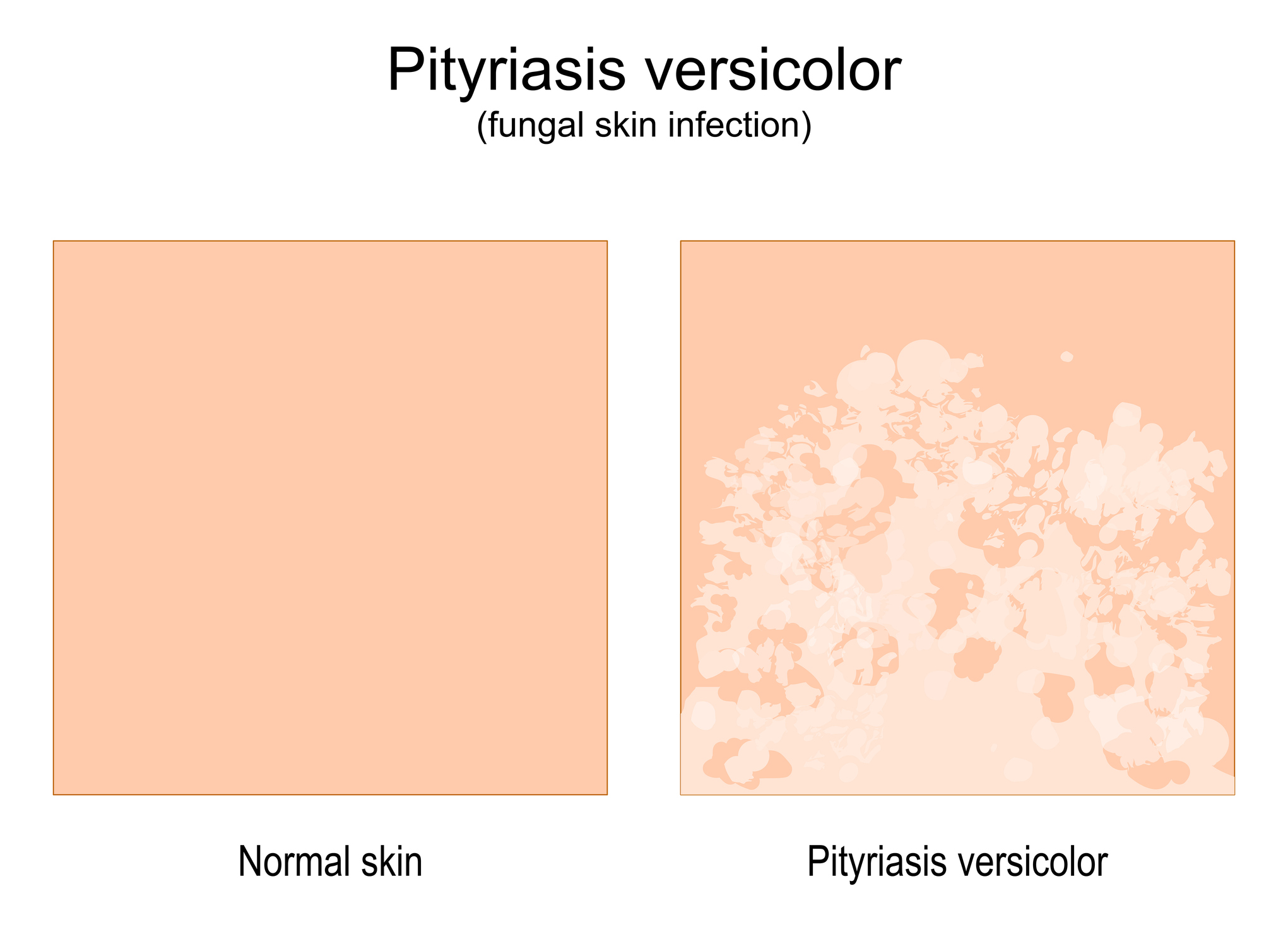 Porovnanie normálnej kože a kože s príznakmi ochorenia