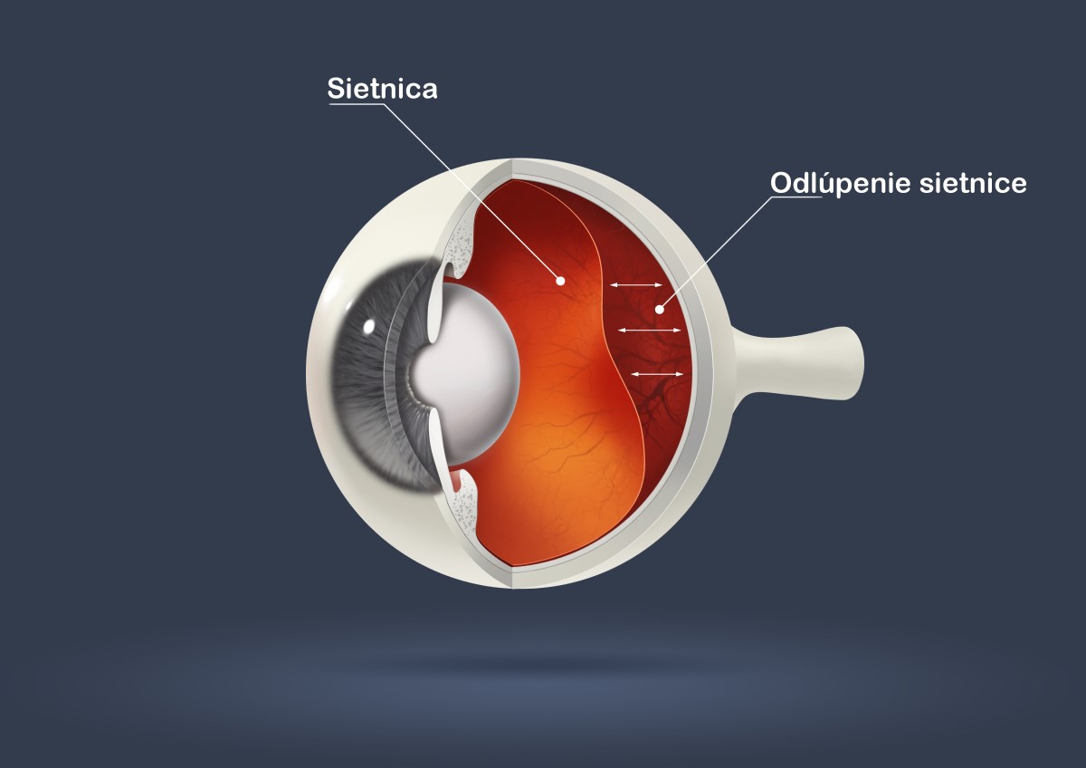 Anatomické zobrazenie oddelenia vrstiev oka