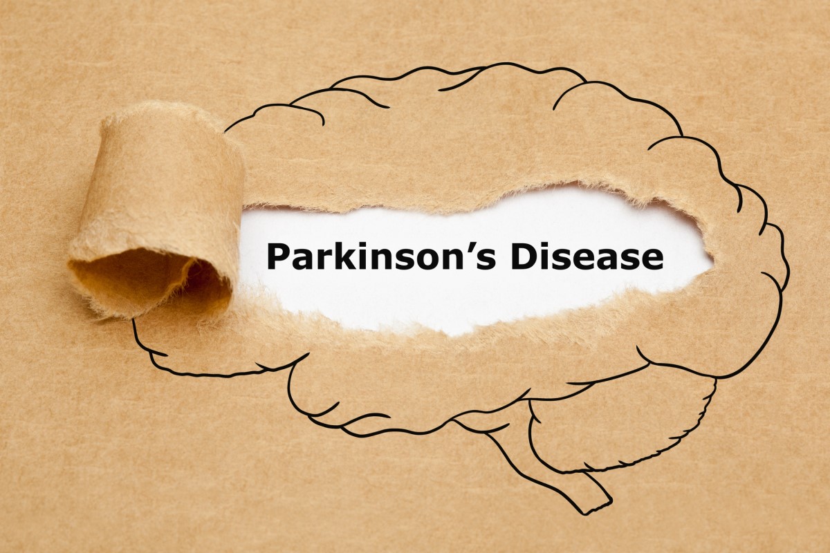 Morbus parkinson = parkinsons disease = parkinsonova choroba - animácia mozgu s nápisom Parkinsons disease uprostred