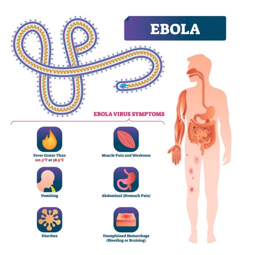 Príznaky eboly
