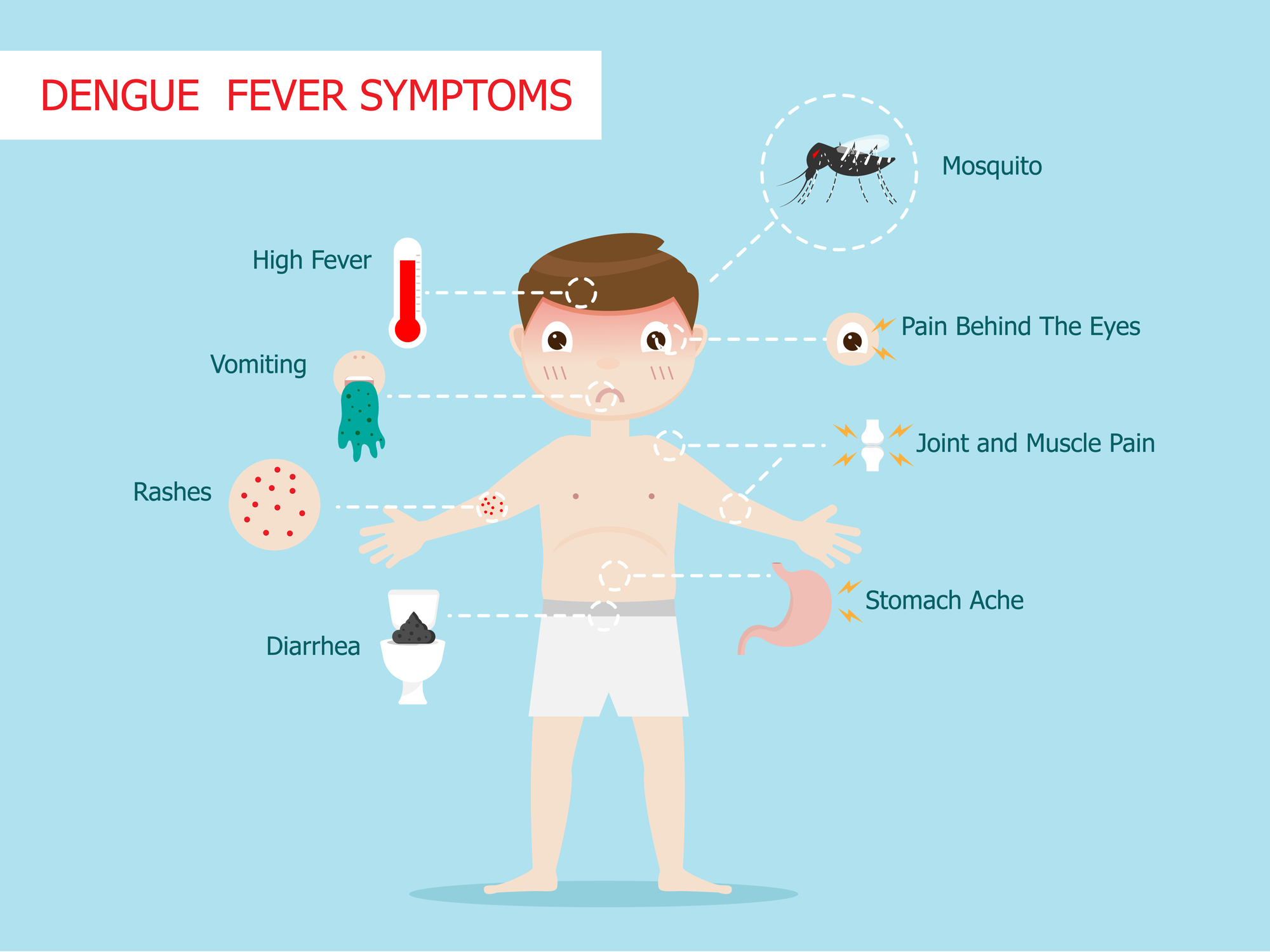 Príznaky horúčky dengue