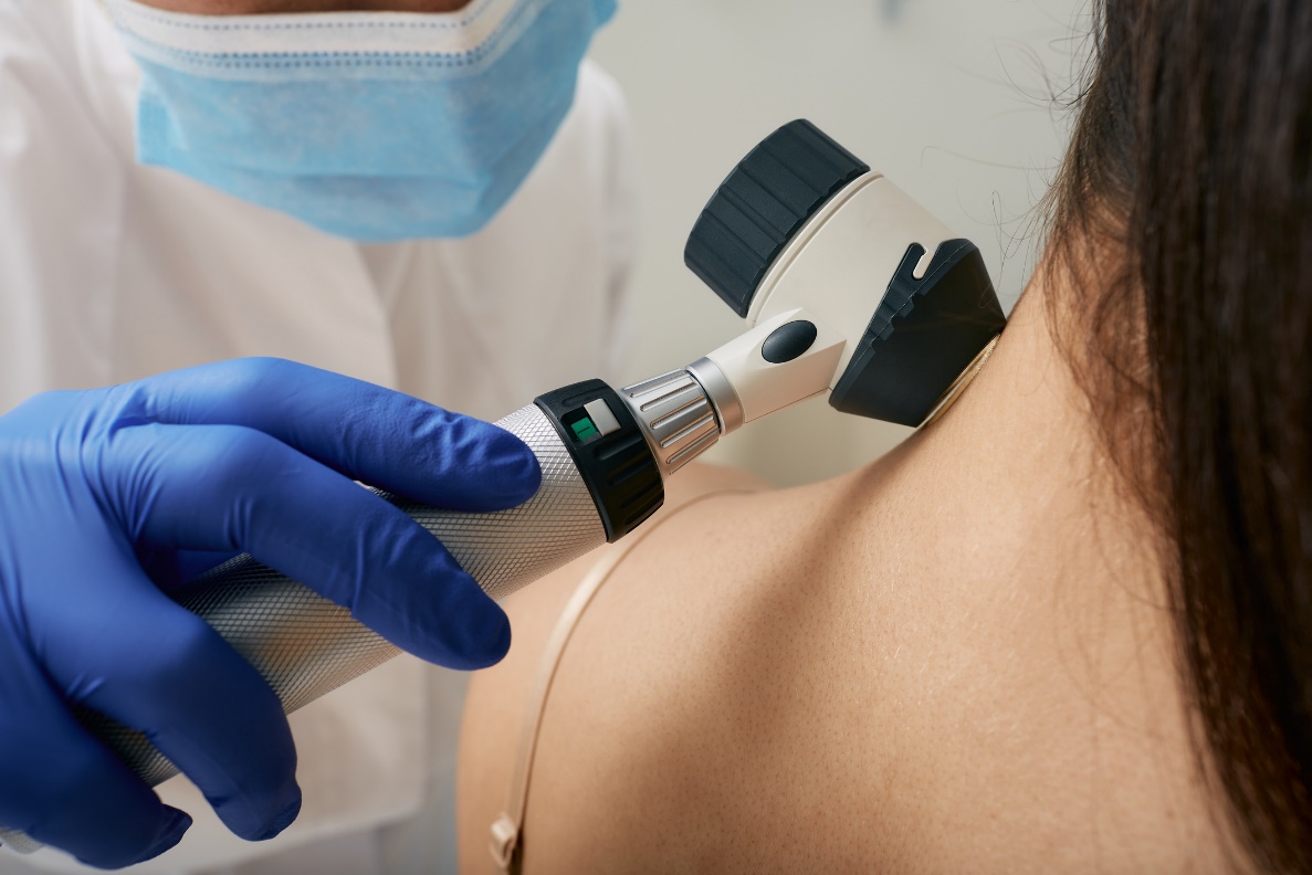 Lekárske vyšetrenie kožných útvarov dermaskopom