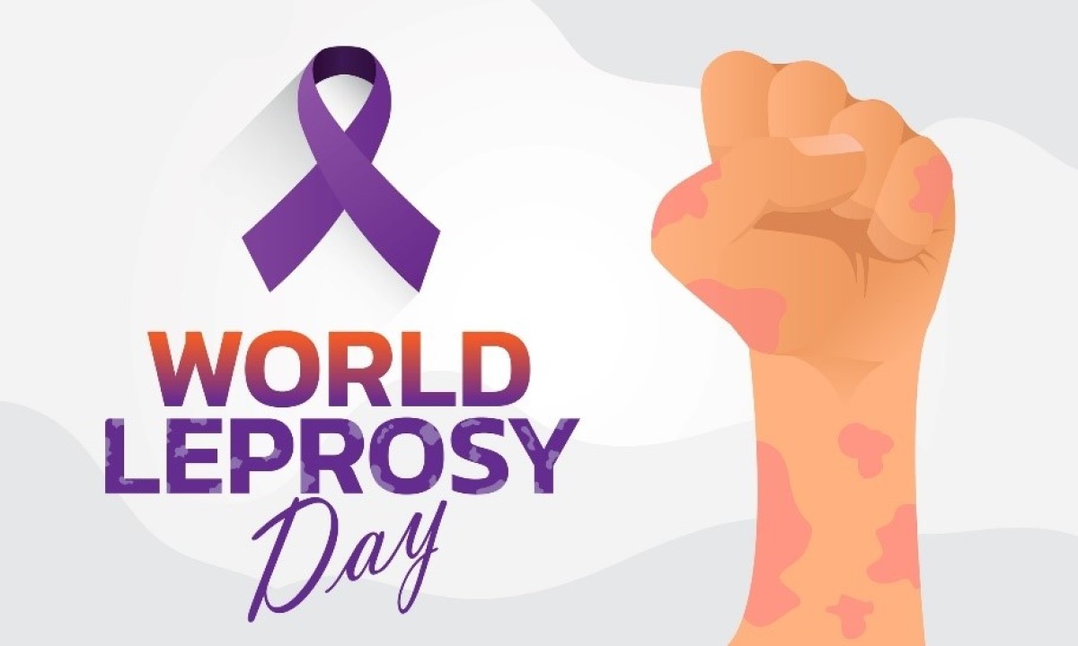 Svetový deň boja proti ochoreniu lepry