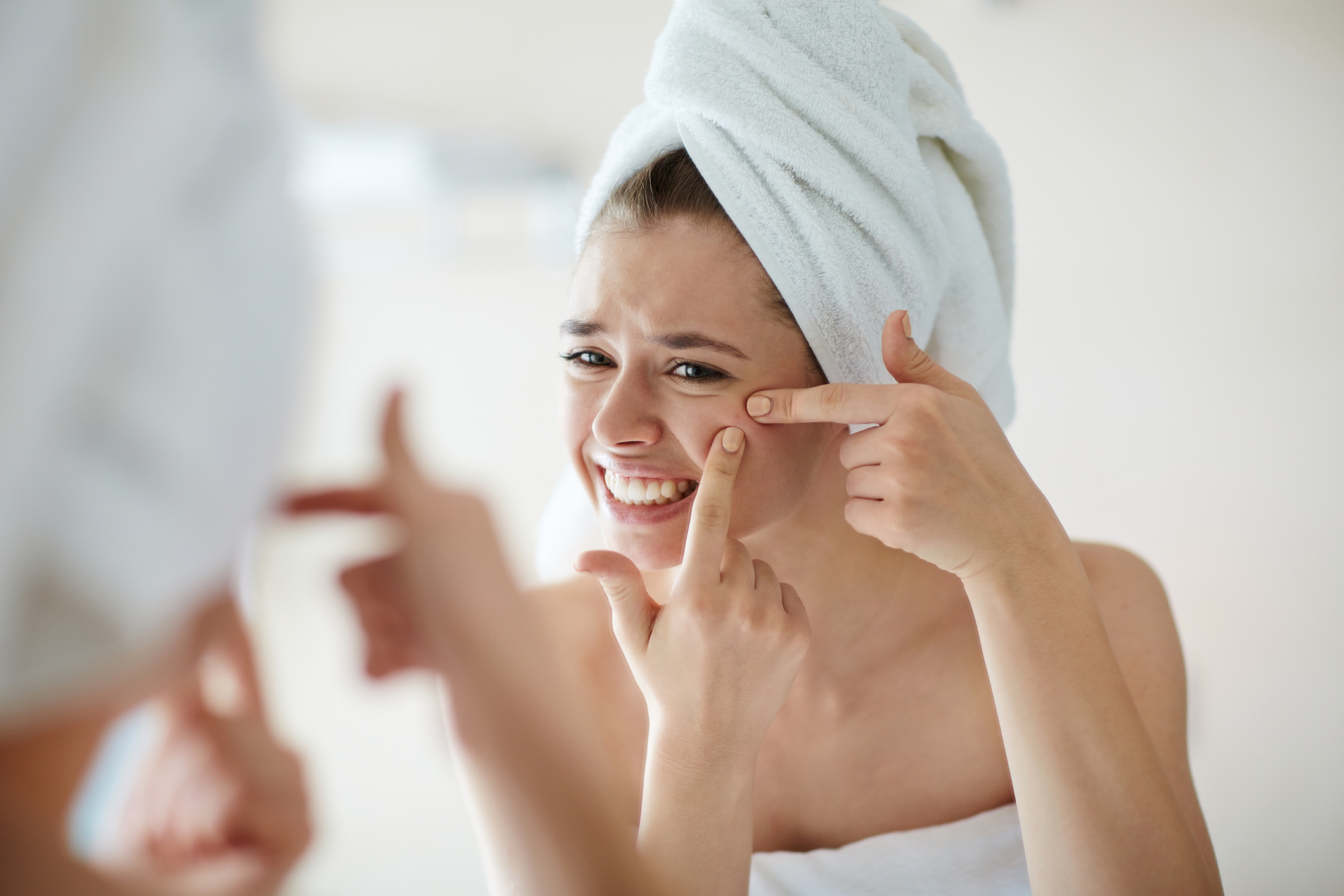 Žena s akné na tvári, vytláča si pupáky, má uterák na vlasoch