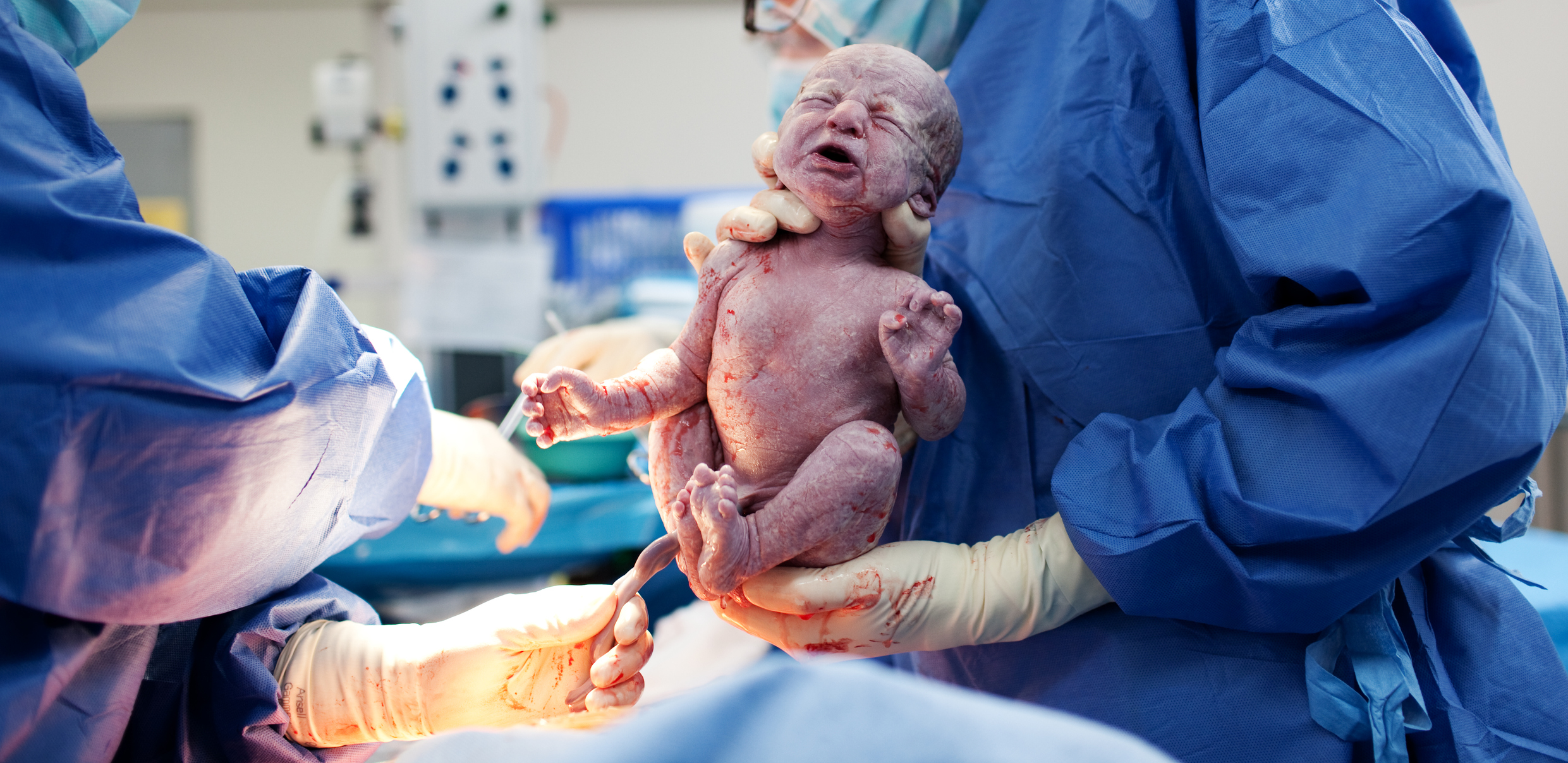 Neugeborenes kurz nach der Geburt.