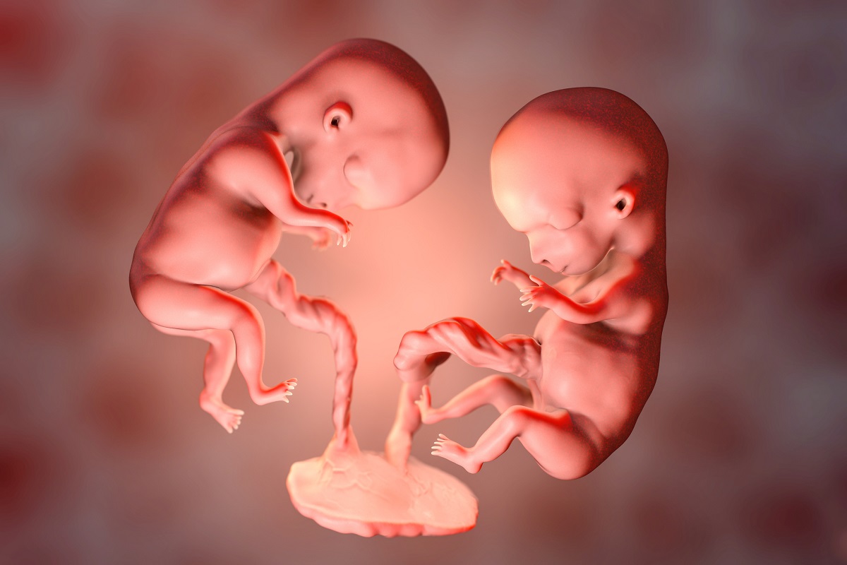 Identical twins in the 8th week of pregnancy. Source photo: Getty Images