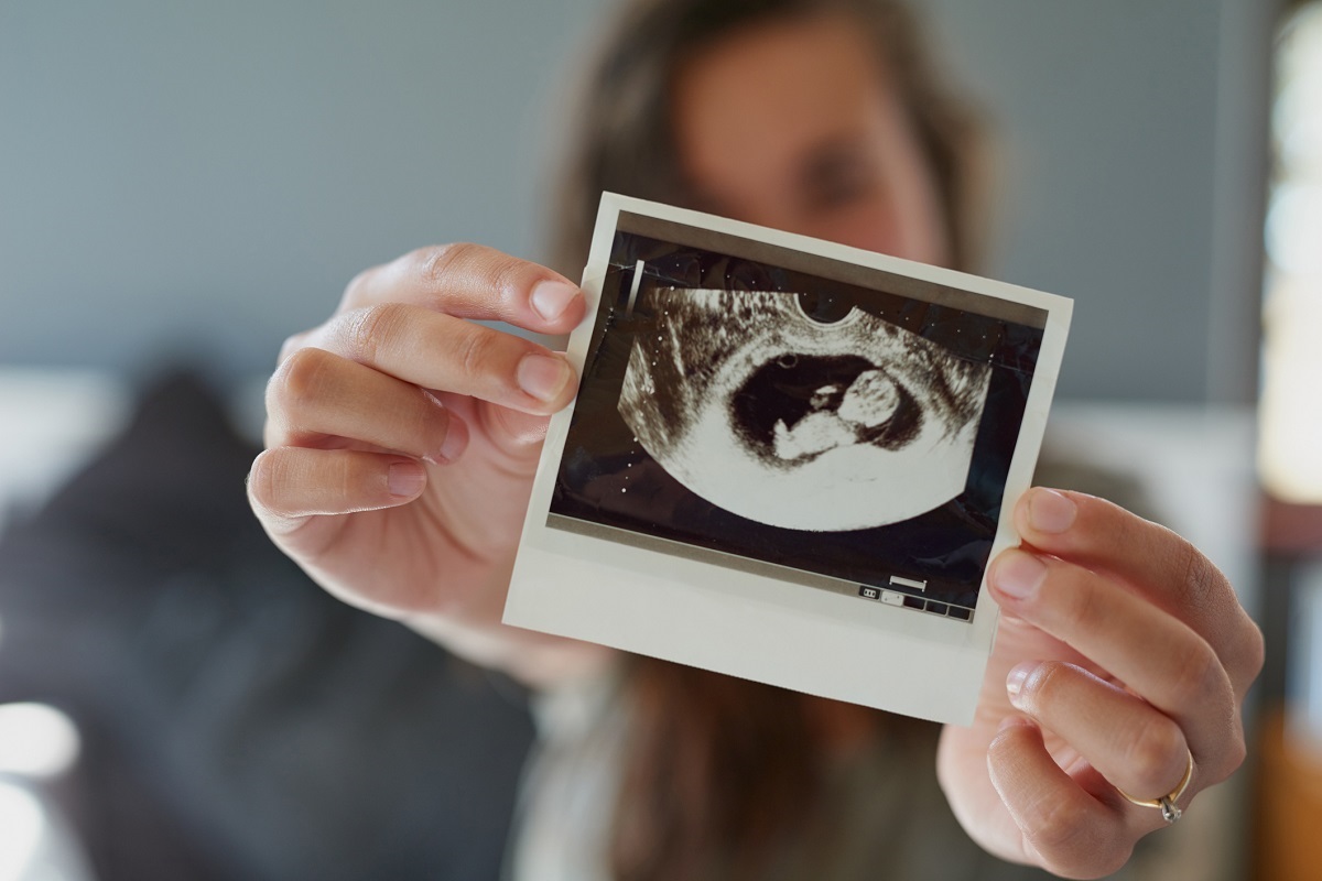 A pregnant woman holds a photo of her baby's sonogram. Source: Getty Images