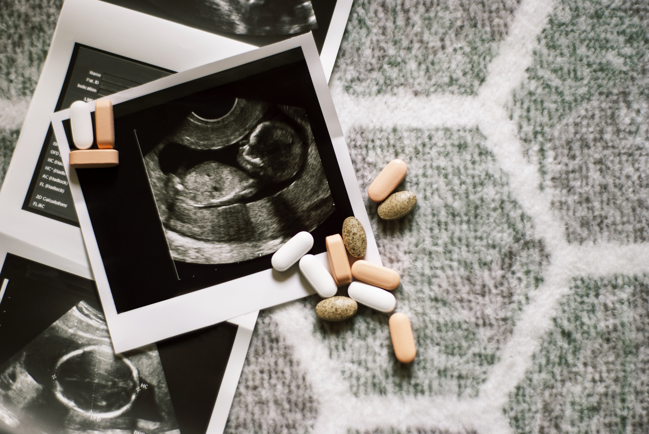 Some drugs taken during pregnancy can harm fetal development. Source: Getty Images