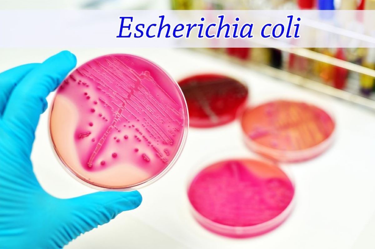 Znázornenie kultivácie baktérie Escherichia coli