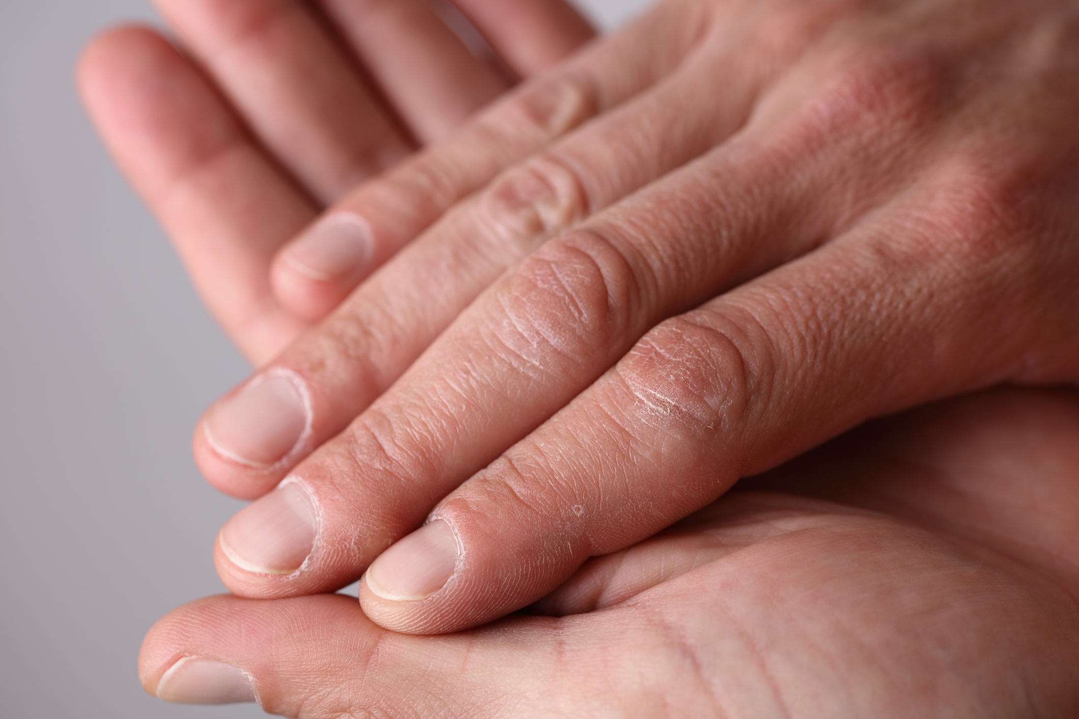 Ako na starostlivosť o ruky? 3 kroky: Umývanie, dezinfekcia, krémovanie