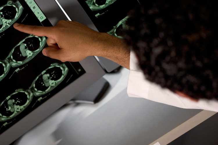 lekár ukazuje na obrazovku počítača so schémou mozgu