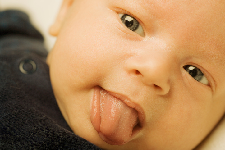 dieťa so žltačkou vyplazuje jazyk