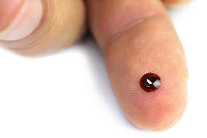 Glykémia - kvapka krvi na brušku prsta po vpichu ihlou na meranie cukru v krvi