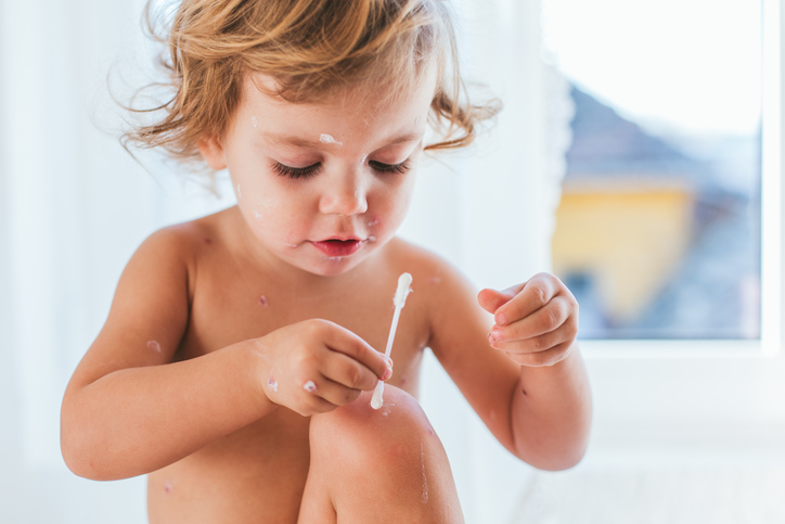 Nahé dieťa si ošetruje pokožku s pomocou vatovej tyčinky