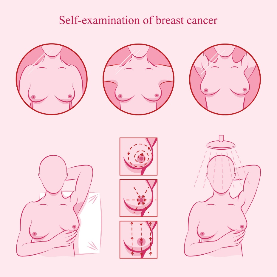 Ilustrácia samovyšetrenia prsníkov