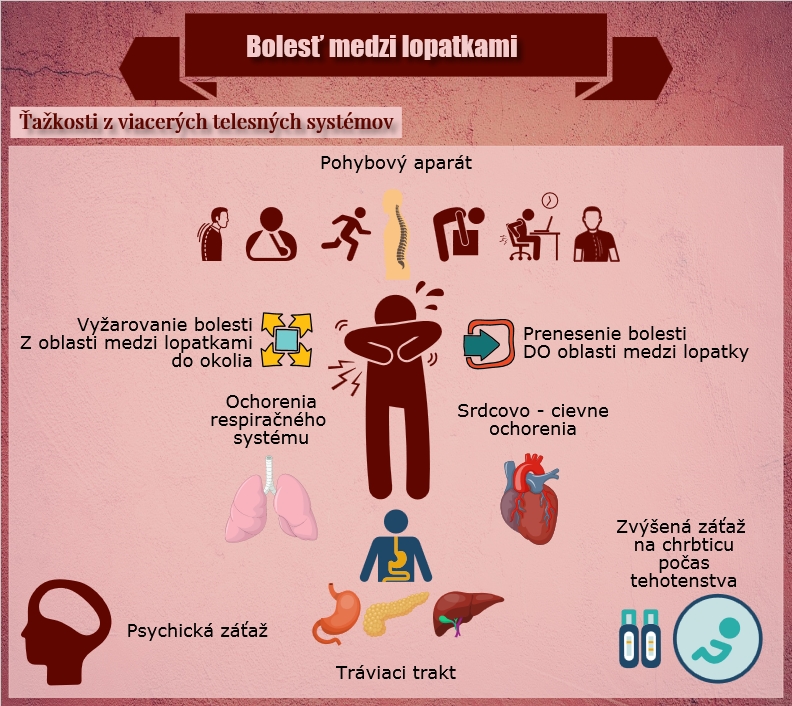 Informácie k bolesti medzi lopatkami Infografika uvádza príčiny bolesti medzi lopatkami a, z ktorých telových systémov je spôsobená