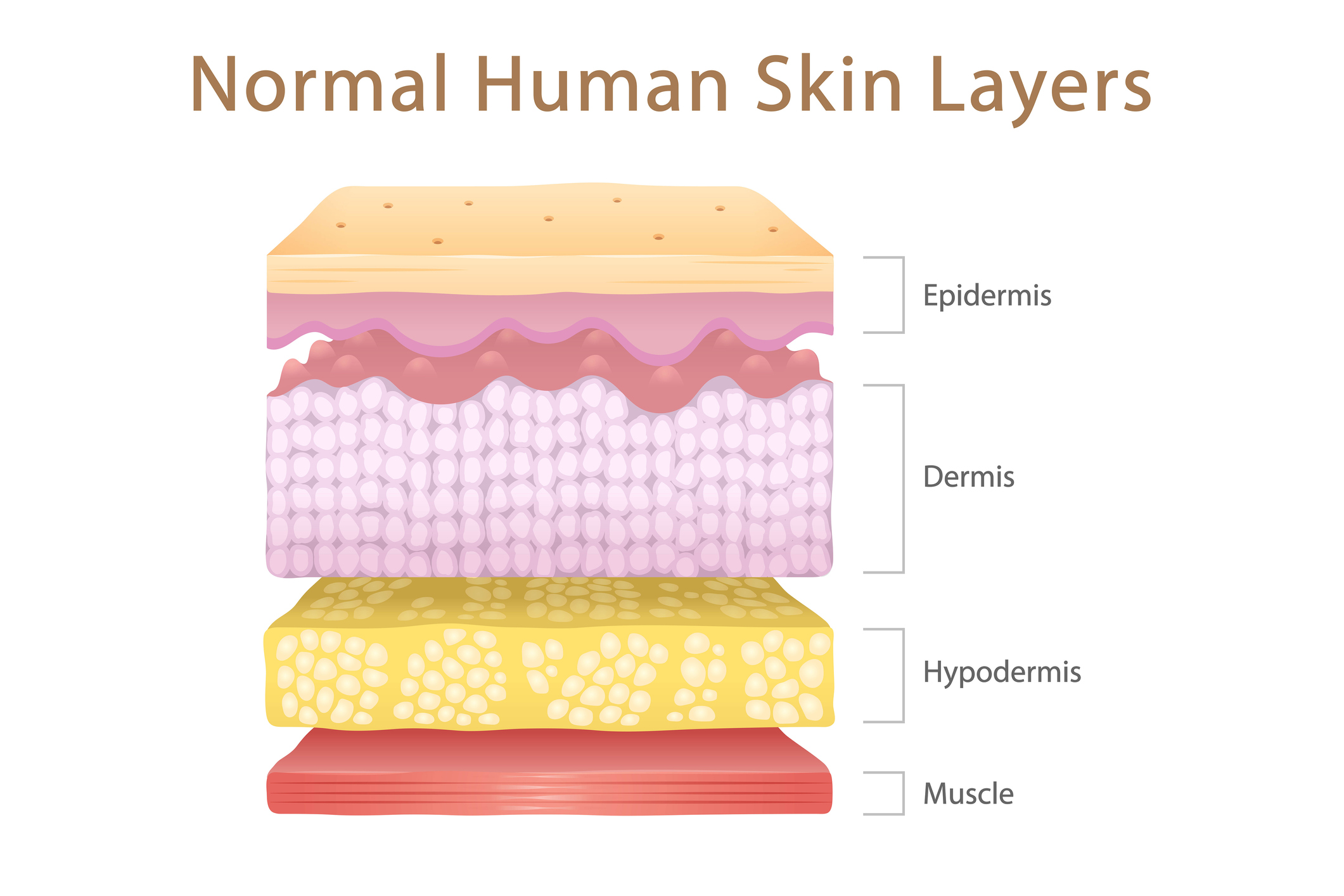 Časti kože, pokožka, zamša, podkožné tkanivo a svaly