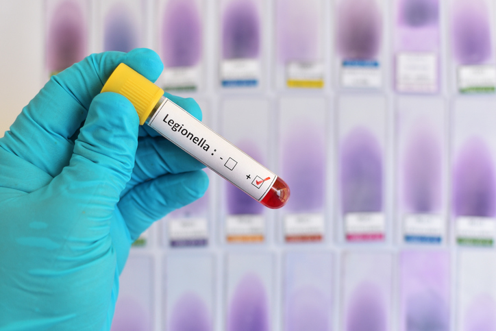 Legionella ako nevítaný hosť do domu. Ako nás môže táto baktéria ohroziť?