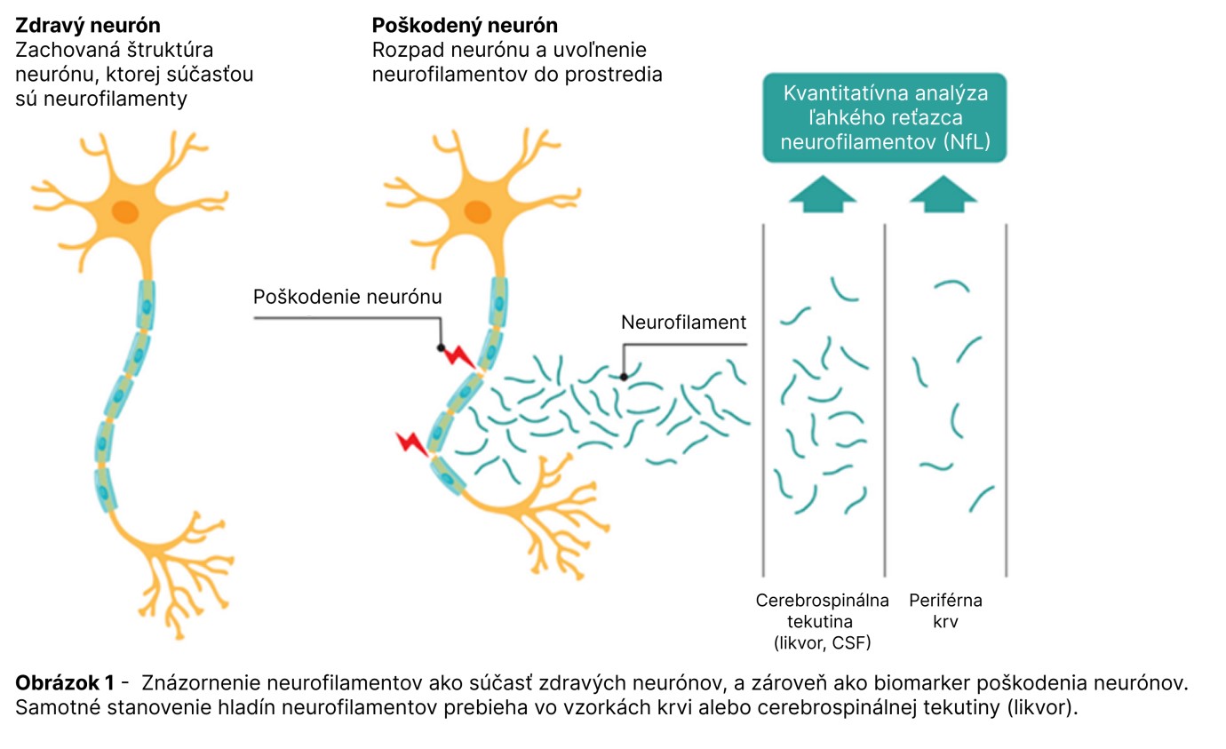 Obrázok 1 - prevzaté z: Wellmann S, Geis T, Kuhle J, Lehnerer V. Neurofilament Light Chain as Biomarker in Encephalitis. J Clin Med. 2024 Sep 12;13(18):5416. doi: 10.3390/jcm13185416. Obrázok 1 - prevzaté z: Wellmann S, Geis T, Kuhle J, Lehnerer V. Neurofilament Light Chain as Biomarker in Encephalitis. J Clin Med. 2024 Sep 12;13(18):5416. doi: 10.3390/jcm13185416.