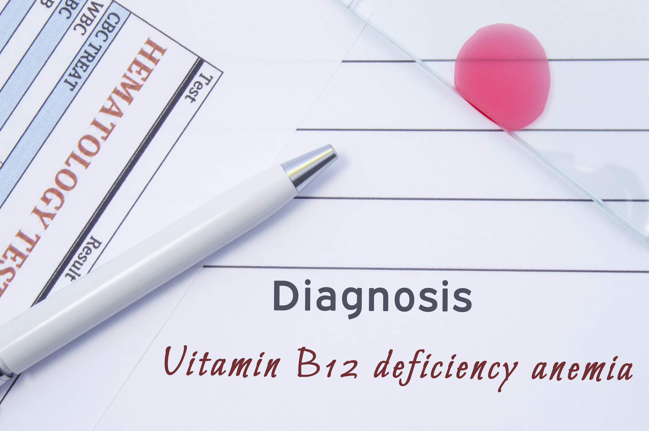 Nedostatok vitamínu B12 môže spôsobiť pernicióznu anémiu
