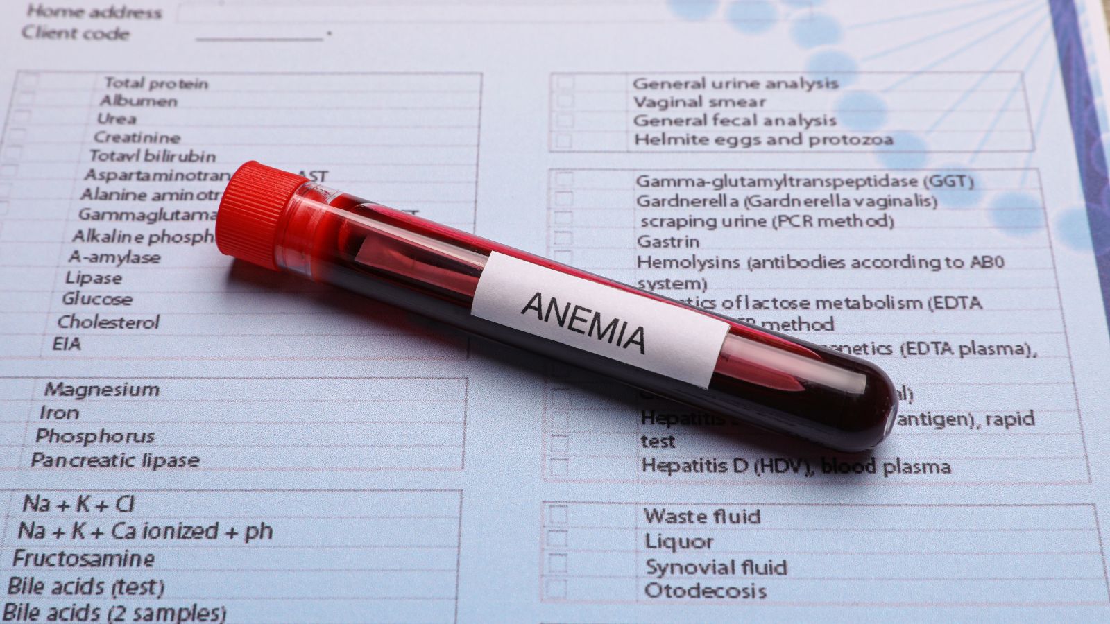 Nedostatok železa zapríčiňuje nedostatočnú tvorbu hemoglobínu a druhotne i nedostatok červených krviniek, znižuje sa fyzická výkonnosť a môžu sa dostaviť pocity nevoľnosti. Tento stav sa nazýva anémia z nedostatku železa. Vyskytuje sa aj u mnohých tehotných žien. Zdroj foto: Canva Skúmavka s odobratou krvou a štítkom s názvom anémia, je položena na žiadanke k laboratórnemu vyšetreniu krvi.