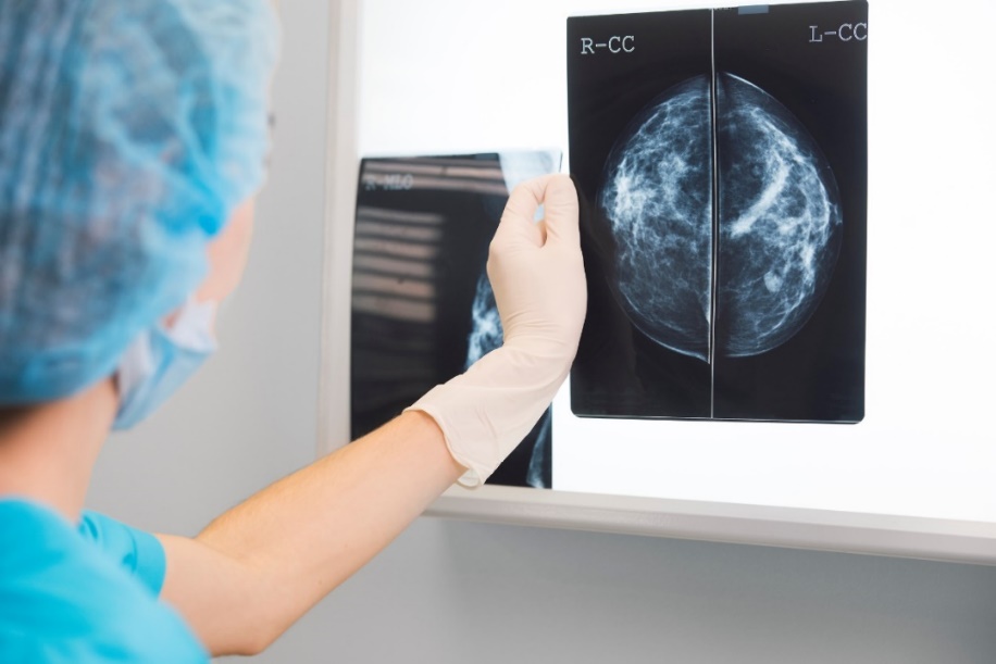 Snímok prsníka z Mamografického vyšetrenia