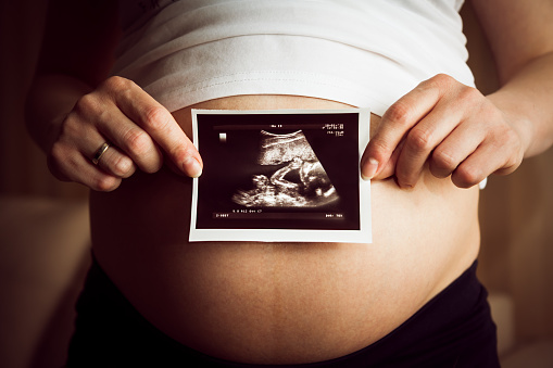 Tehotná žena drží sono s obrázkom dieťatka