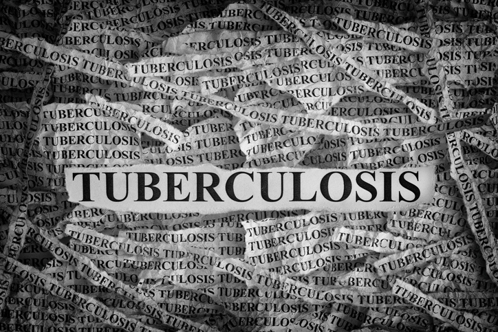 Tuberkulóza nepatrí minulosti, ročne zabíja milióny ľudí. Poznáte fakty a mýty?