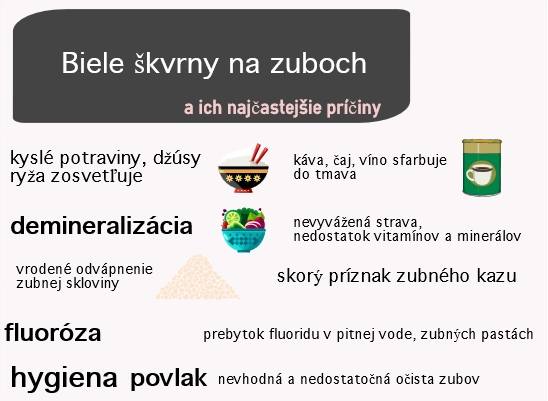 Zhrnutie najčastejších príčin bielych škvŕn na zuboch Infografika o najčastejších príčinách bielych škvŕn na zuboch