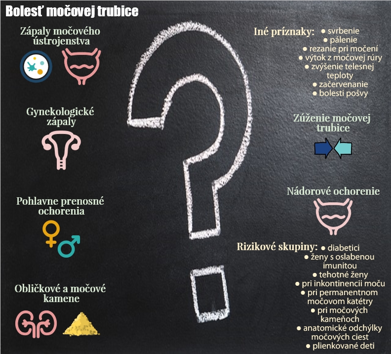 Súhrnné informácie o bolesti močovej trubice na jednom mieste Infografika uvádza najčastejšie príčiny boelsti močovej trubice