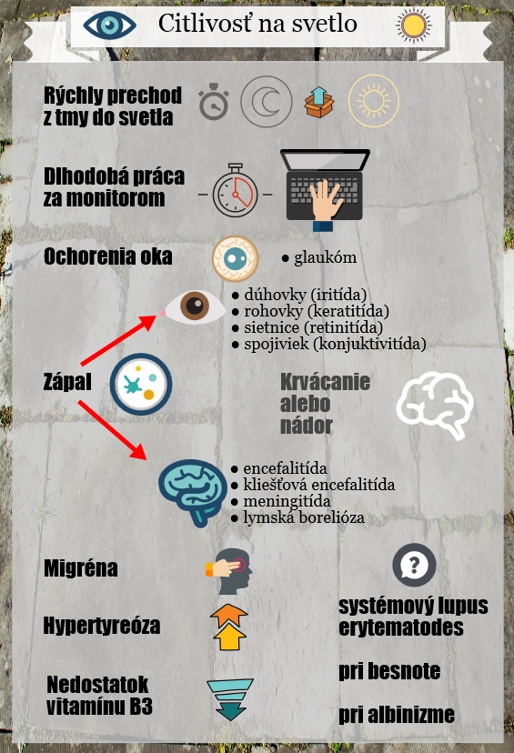 Súhrn hlavných príčin citlivosti na svetlo Infografika uvádza hlavné príčiny citlivosti na svetlo