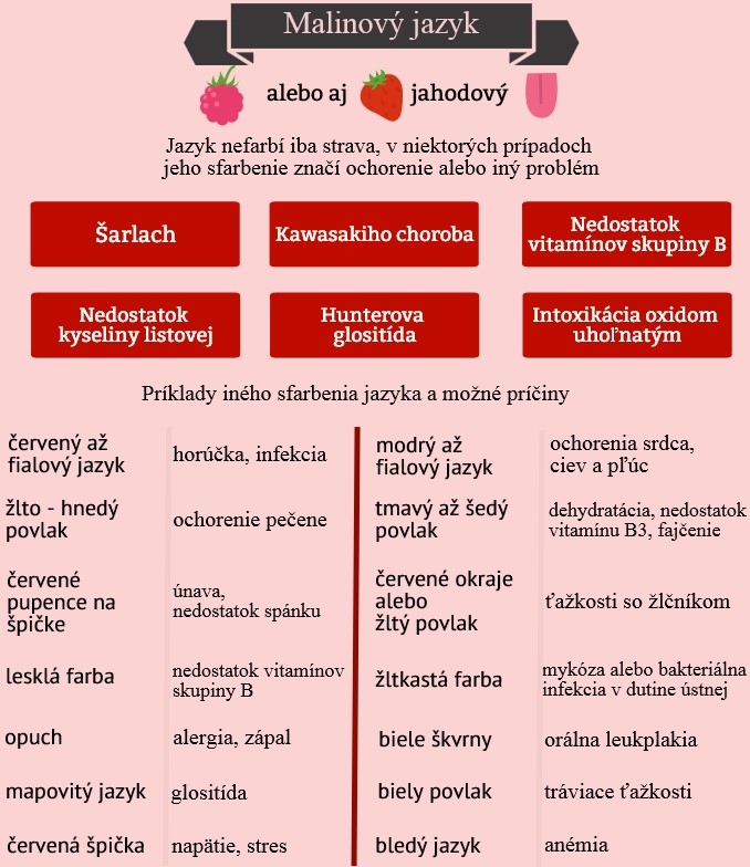 Príčiny malinového jazyka. Iné možné farby a ich príčiny Infografika uvádza príčiny malinového jazyka a ostatné možné sfarbenia jazyka a ich príčiny