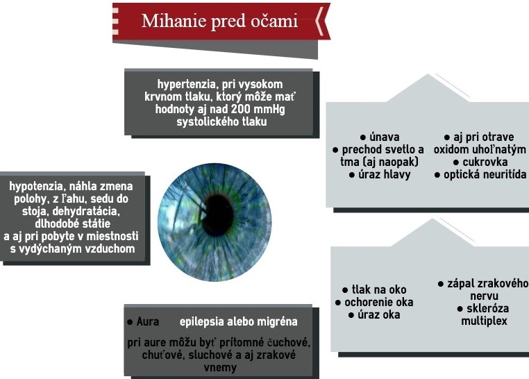 Najčastejšie príčiny mihana pred očami Infografika o príčinách mihania pred očami